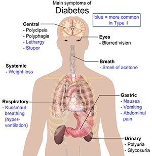 symptoms-diabetes